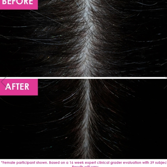 Grande Hair Set | Full Size 3 Pc System - Picture 7 of 7